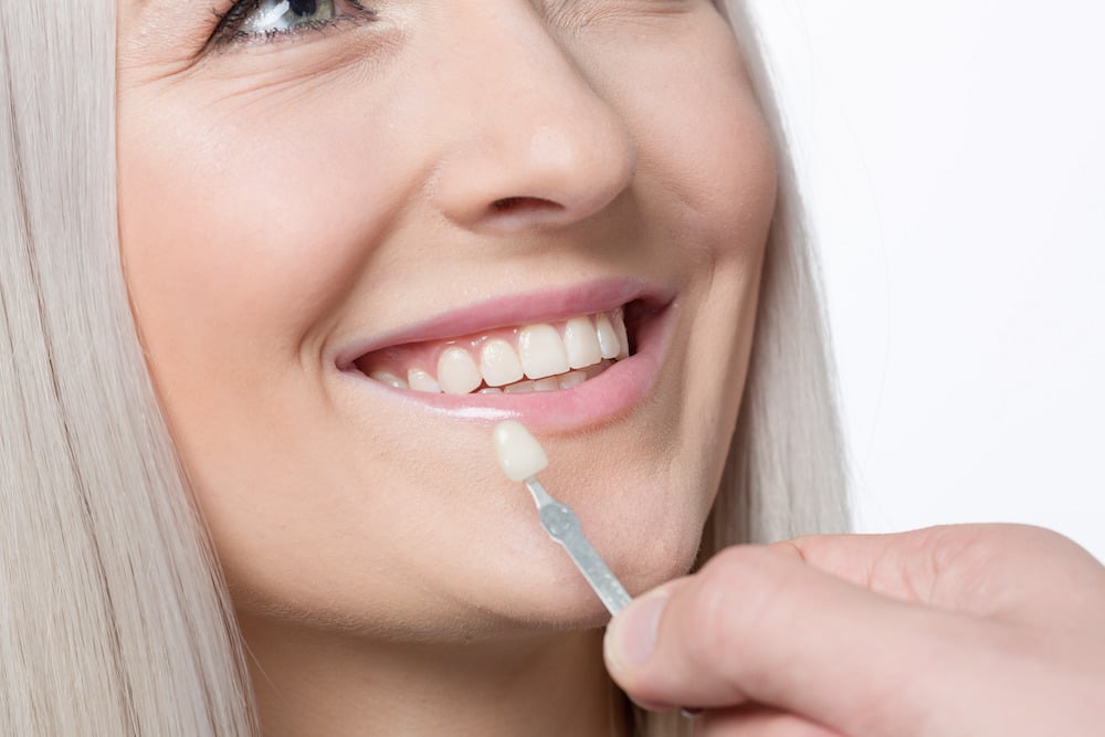 How Much Do Porcelain Veneers Cost in Franklin, TN?